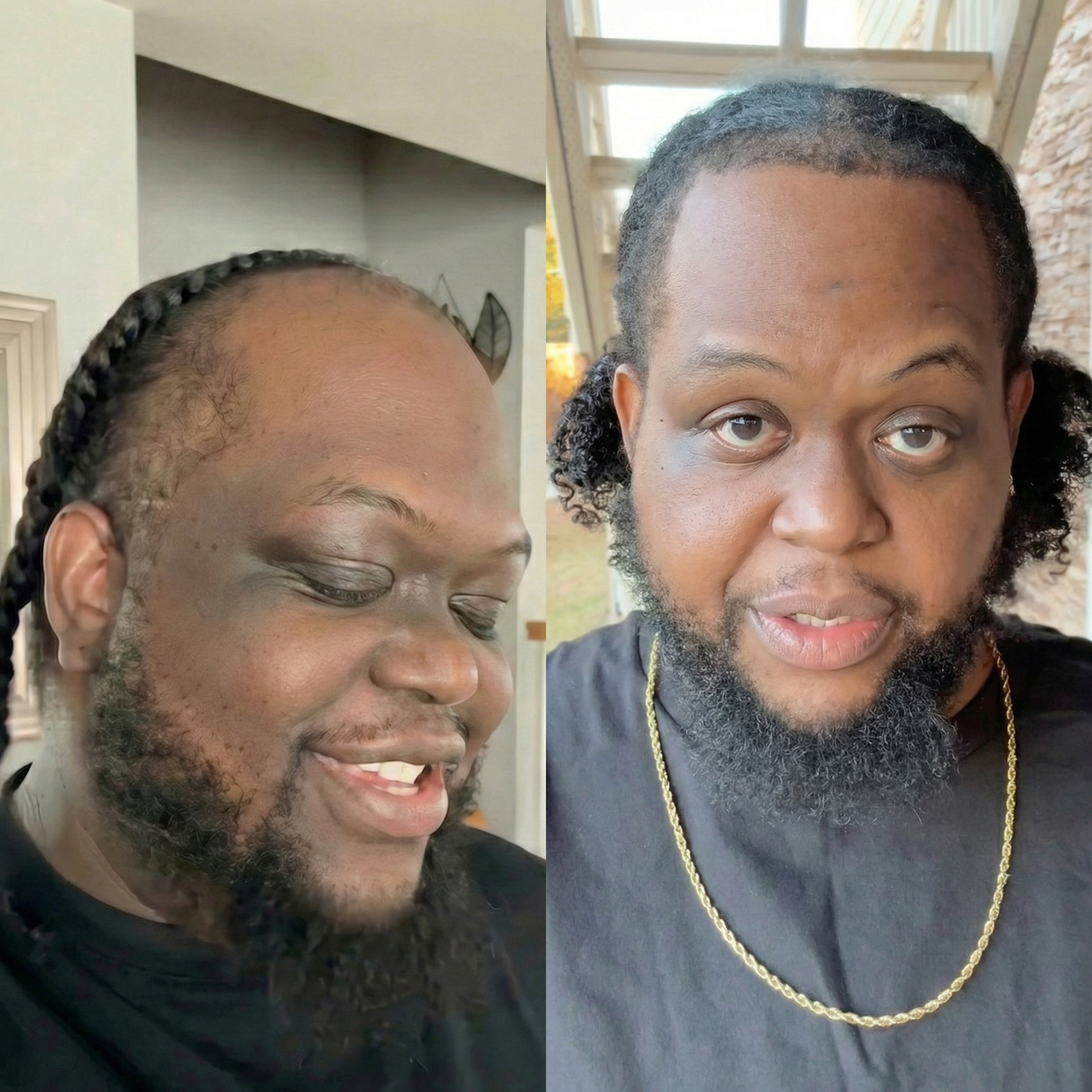 Malcom C. transformation