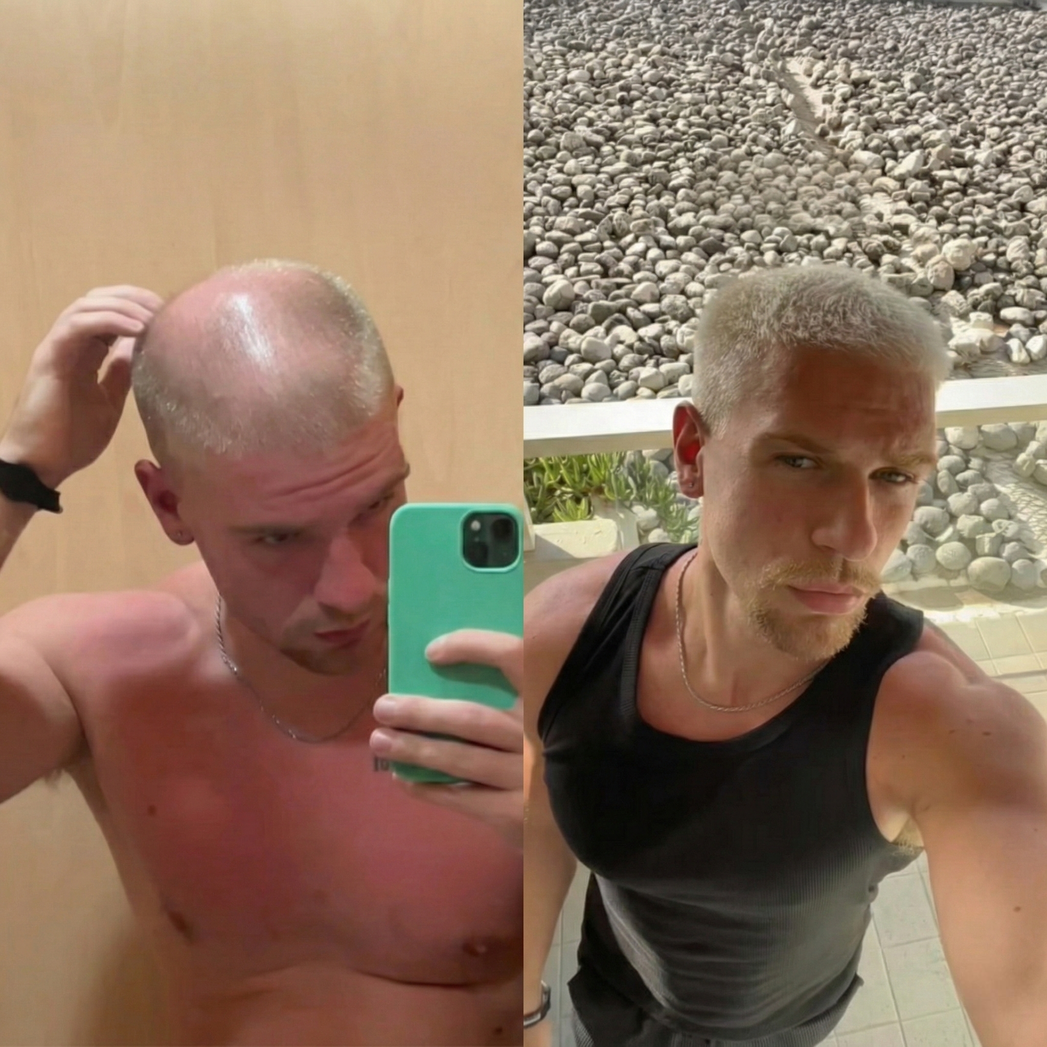 Jack S. transformation